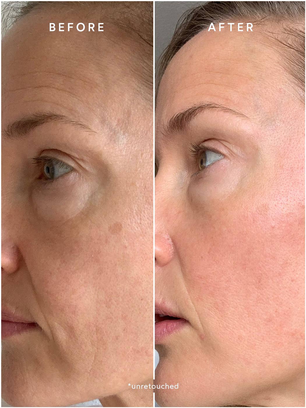 Renew Chebula Active Serum