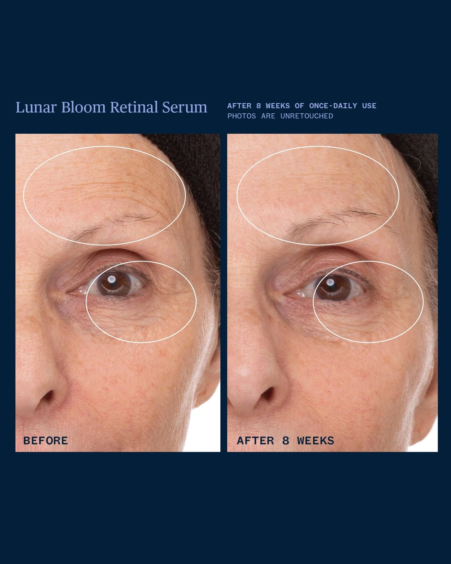 Lunar Bloom Retinal Serum