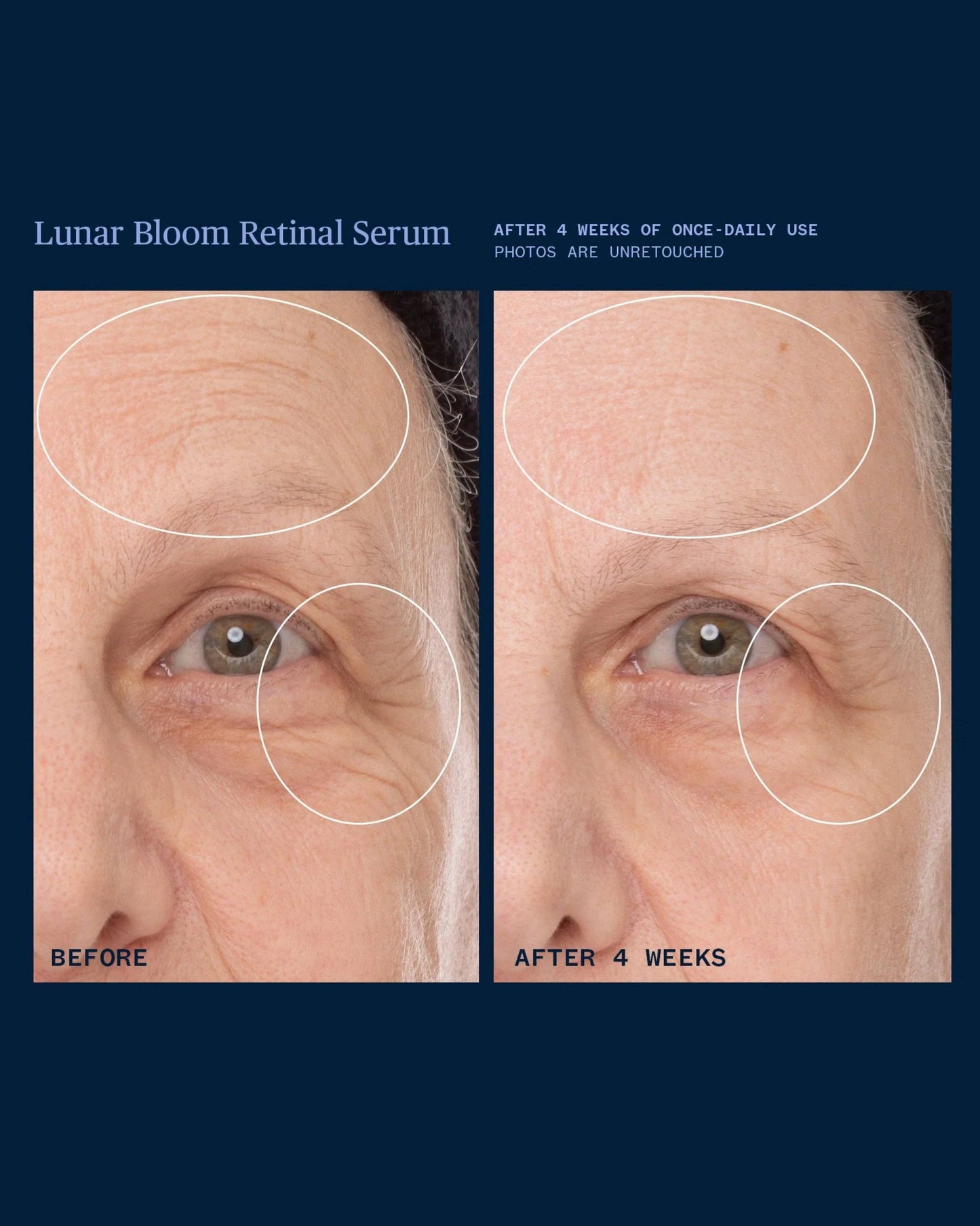 Lunar Bloom Retinal Serum