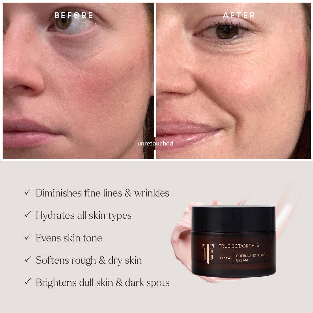 Deep Hydration Renewal Daily Essentials