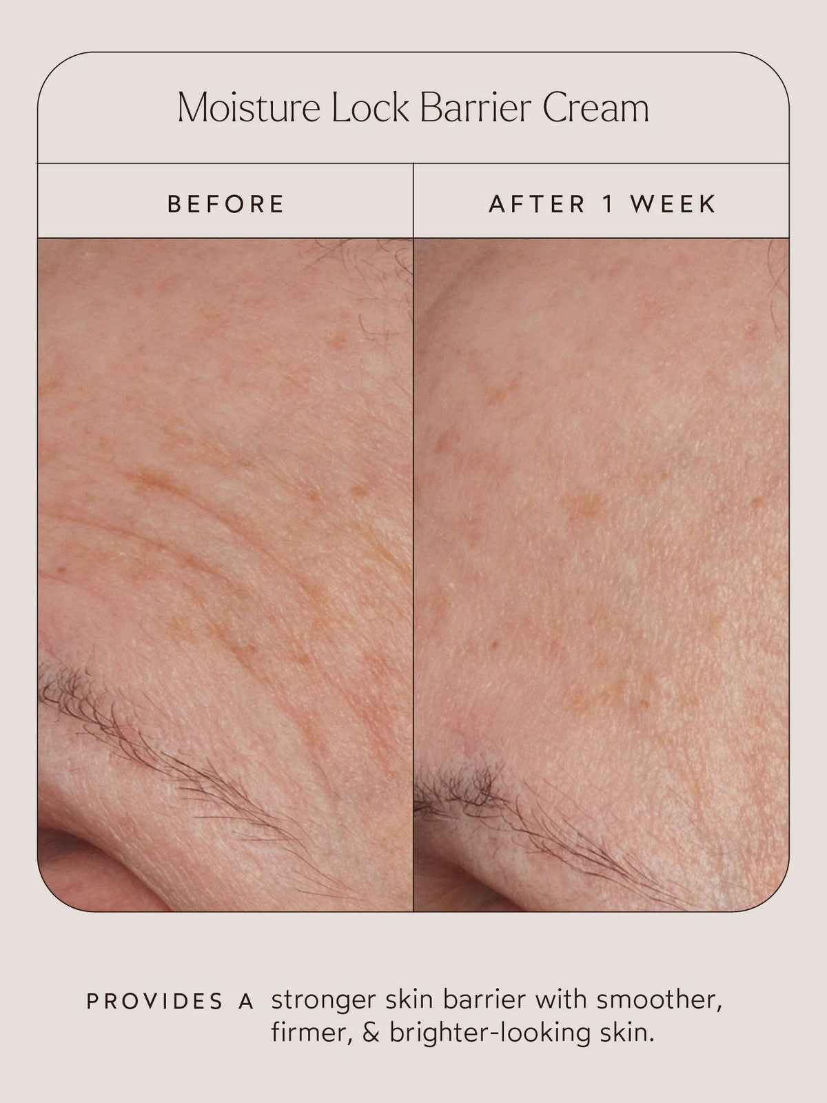 Moisture Lock Barrier Cream