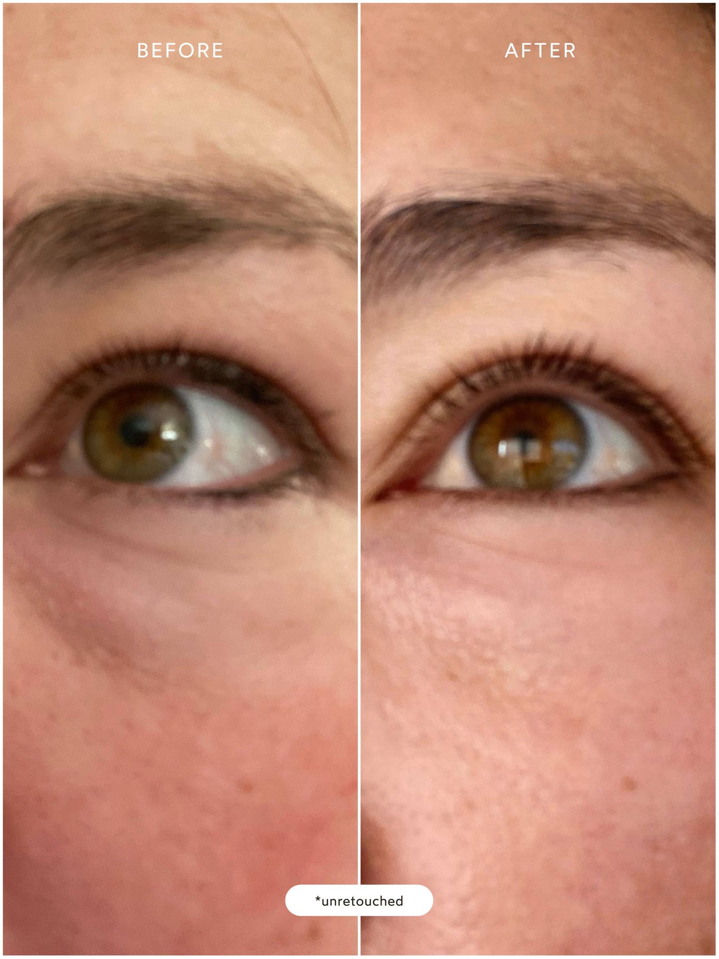 Renew Resurrection Radiance Eye Cream