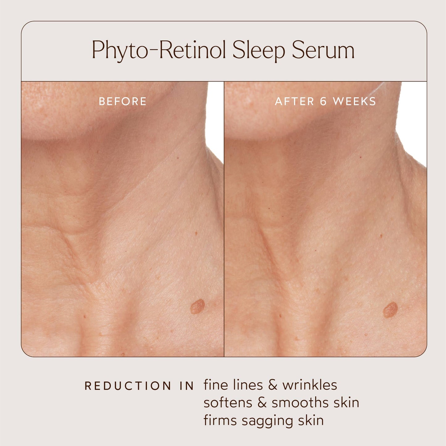 Phyto Retinol Anti-Aging Sleep Treatmen